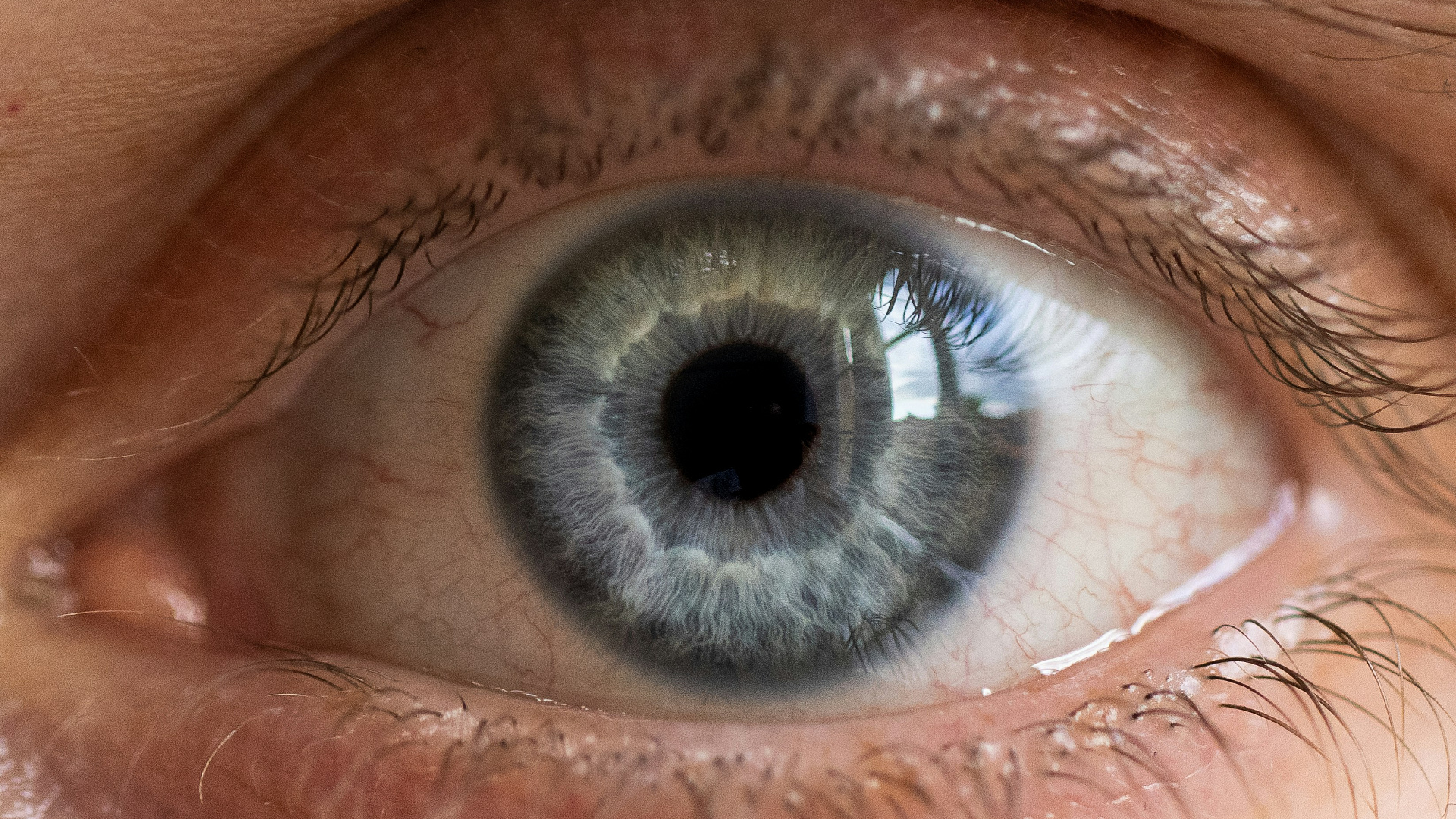 Почему краснеют глаза?